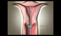 ostetriciaeginecologia en videogallery-department-of-obstetrics 028