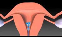 ostetriciaeginecologia en videogallery-department-of-obstetrics 021