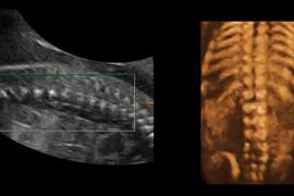 ostetriciaeginecologia en osbtectrical-ultrasound 004