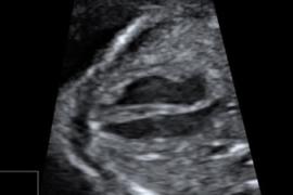 ostetriciaeginecologia en osbtectrical-ultrasound 005