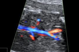 ostetriciaeginecologia en osbtectrical-ultrasound 008