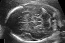 ostetriciaeginecologia en osbtectrical-ultrasound 001
