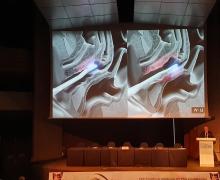 2022.05.13 Some moments of the report by Dr. Maurizio Filippini at the XXXI Update Meeting of the Brazilian Association of Pathology of the Lower Genital Tract and Colposcopy (ABPTGIC) - CERVICOLP, held in Sao Paulo, Brazil at the Centro de Convenções Rebouças