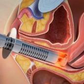 ostetriciaeginecologia it laparoscopia-ginecologica 084