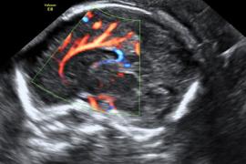 ostetriciaeginecologia en osbtectrical-ultrasound 002