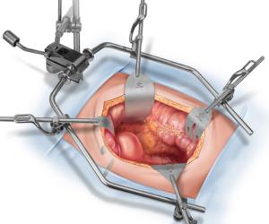 ostetriciaeginecologia it chirurgia-ginecologia-colpo-laparotomica 002