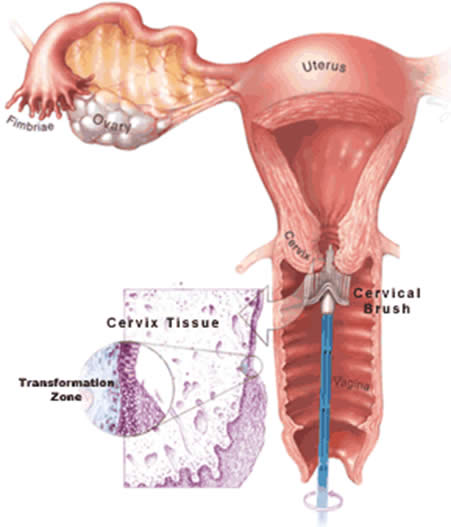 ostetriciaeginecologia en hpv-test 002